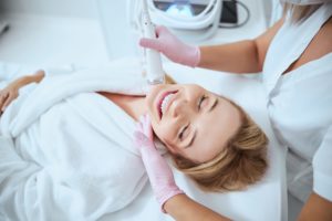The Benefits of Microneedling for Acne Scars