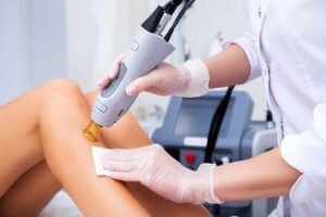 Laser Hair Removal by Elevate Aesthetics in Sanford FL