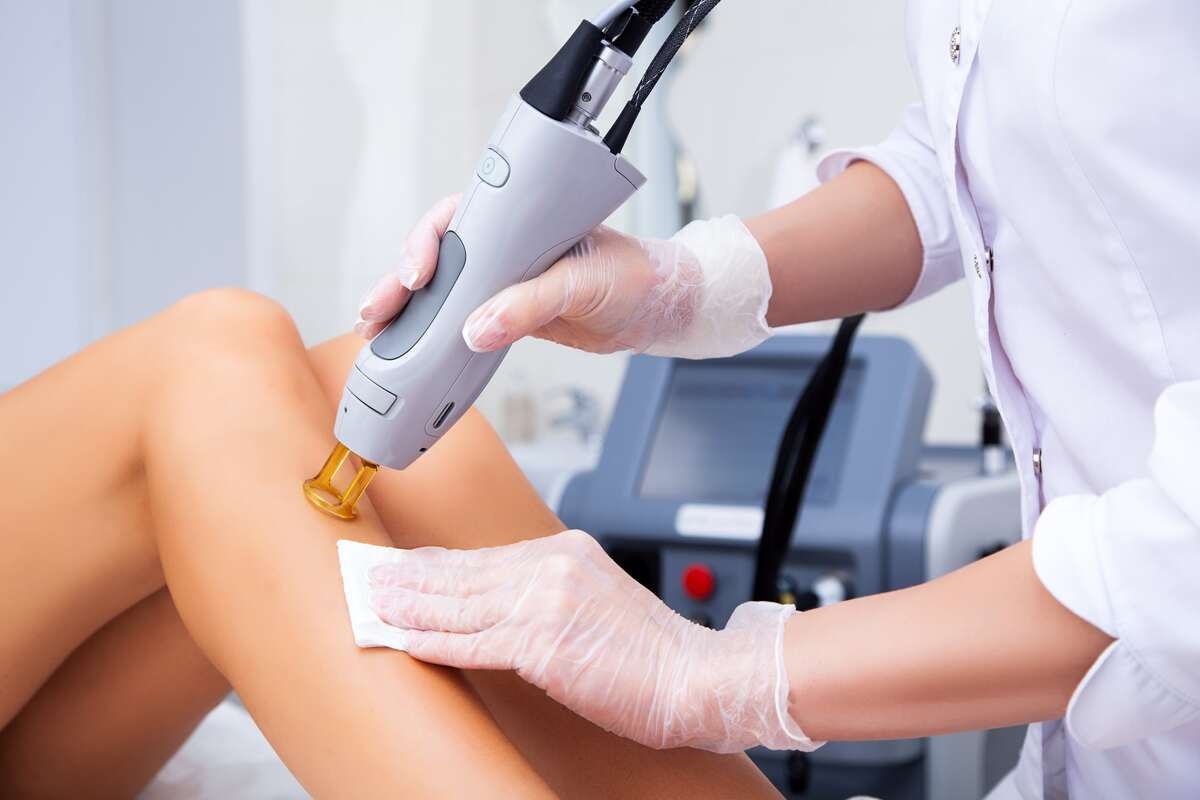 Laser Hair Removal by Elevate Aesthetics in Sanford FL