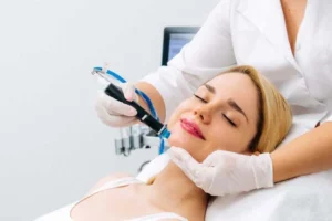 Microneedling with PRF in Sanford, FL by Elevate Aesthetics