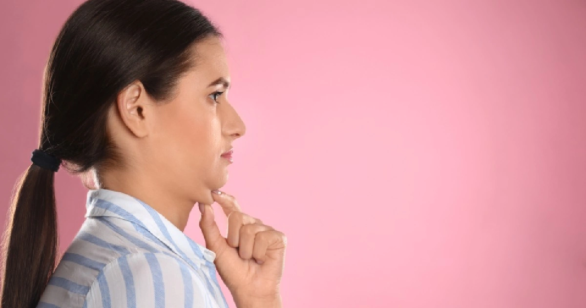 Women receiving Kybella Treatment in Sanford, FL